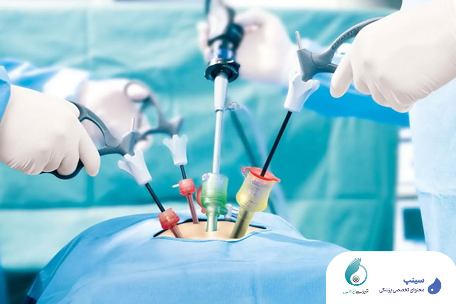 دوره کولکتومی لاپاروسکوپی